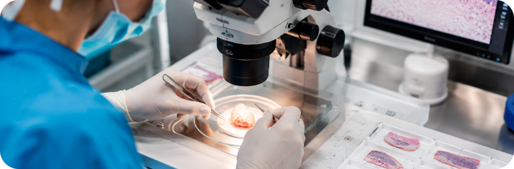 Cirurgia Micrográfica de Mohs interna - Dra Luciana Borsoi